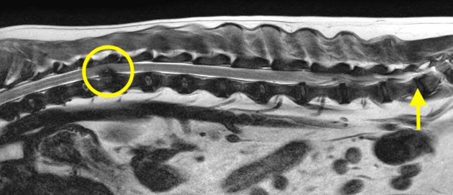 Ressonância magnética de um cão com hérnia de disco (extrusão do disco intervertebral) com compressão da medula espinhal no meio da coluna (círculo demonstrando a compressão na região T12-13).